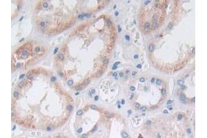 Immunohistochemistry (IHC) image for anti-Acid Phosphatase, Prostate (ACPP) (AA 217-386) antibody (ABIN7431248)