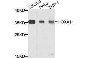 Western blot analysis of extracts of various cell lines, using HOXA11 antibody (ABIN1873073) at 1:1000 dilution. (Homeobox A11 Antikörper)