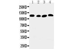 Anti-SERCA2 ATPase antibody, Western blotting Lane 1: Rat Skeletal Muscle Tissue Lysate Lane 2: Rat Kidney Tissue Lysate Lane 3: PANC Cell Lysate Lane 4: SMMC Cell Lysate (ATP2A2 Antikörper  (Middle Region))