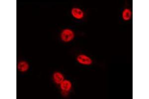 Immunofluorescence (fixed cells) (IF/ICC) image for anti-POU Domain, Class 4, Transcription Factor 3 (POU4F3) (Internal Region) antibody (ABIN6257424)