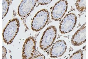 IHC analysis of CDK1 using anti-CDK1 antibody (ABIN7602240). (CDK1 Antikörper  (AA 66-297))