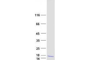 Western Blotting (WB) image for Chemokine (C-C Motif) Ligand 4 (CCL4) (Transcript Variant 1) protein (Myc-DYKDDDDK Tag) (ABIN2726032)