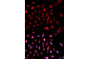 Immunofluorescence analysis of U2OS cells using ASH2L antibody (ABIN5973125). (ASH2L Antikörper)