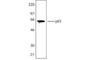 Image no. 1 for anti-Nuclear Factor-kB p65 (NFkBP65) (C-Term) antibody (ABIN230593) (NF-kB p65 Antikörper  (C-Term))