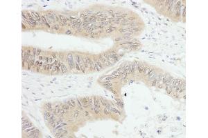 anti-Protein Tyrosine Phosphatase G1 (PTPN12) (AA 710-760) antibody