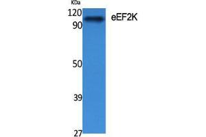 Western Blot (WB) analysis of specific cells using eEF2K Polyclonal Antibody. (EEF2K Antikörper  (Tyr705))