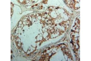 Immunohistochemistry (IHC) image for anti-Transforming Growth Factor, beta Receptor 1 (TGFBR1) (AA 162-403) antibody (ABIN7431737)