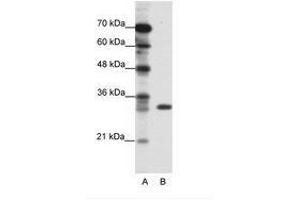 Image no. 1 for anti-Ts Translation Elongation Factor, Mitochondrial (TSFM) (C-Term) antibody (ABIN202296) (TSFM Antikörper  (C-Term))