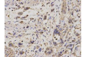 Immunohistochemistry (IHC) image for anti-GDP Dissociation Inhibitor 1 (GDI1) antibody (ABIN1876650) (GDI1 Antikörper)
