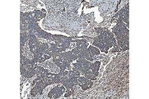 IHC analysis of REA/PHB2 using anti-REA/PHB2 antibody (ABIN7599239). (Prohibitin 2 Antikörper  (AA 1-299))