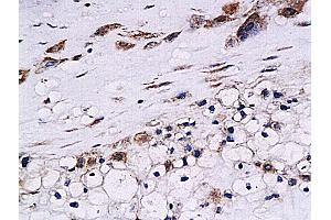 Formalin-fixed and paraffin embedded human placenta labeled with Anti-Cystatin B Polyclonal Antibody, Unconjugated (ABIN755692) at 1:200 followed by conjugation to the secondary antibody and DAB staining (CSTB Antikörper  (AA 51-98))