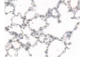 IHC-P analysis of Rat Lung Tissue, with DAB staining. (CES1 Antikörper  (AA 19-300))