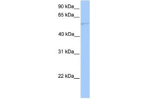 CYP1A1 antibody used at 1 ug/ml to detect target protein.