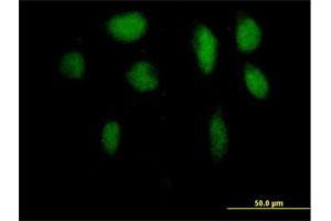 Immunofluorescence of purified MaxPab antibody to ZFP95 on HeLa cell. (ZKSCAN5 Antikörper  (AA 1-839))