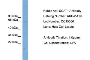 WB Suggested Anti-SOAT1  Antibody Titration: 0. (SOAT1 Antikörper  (Middle Region))