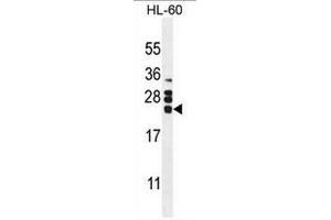 CSF2 Antibody (Center) western blot analysis in HL60 cell line lysates (35µg/lane). (GM-CSF Antikörper  (Middle Region))