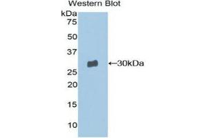 Western Blotting (WB) image for anti-Moesin (MSN) (AA 354-577) antibody (ABIN1859889) (Moesin Antikörper  (AA 354-577))
