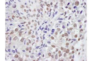 Immunohistochemistry (IHC) image for anti-Tripartite Motif Containing 33 (TRIM33) (AA 650-700) antibody (ABIN7453470)