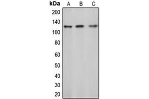 Western blot analysis of c-CBL (pY774) expression in Jurkat (A), mouse liver (B), rat liver (C) whole cell lysates. (CBL Antikörper  (C-Term, pTyr774))