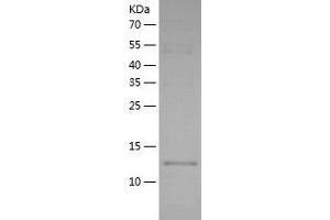 Western Blotting (WB) image for D-Dopachrome Tautomerase (DDT) (AA 1-118) protein (His tag) (ABIN7122595)