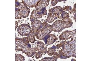 Immunohistochemical staining of human placenta with HPSE2 polyclonal antibody  shows strong membranous positivity in trophoblastic cells. (Heparanase 2 Antikörper)