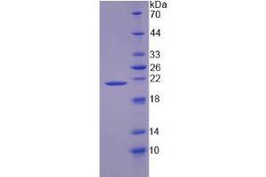 Image no. 1 for Zymogen Granule Protein 16 Homolog B (ZG16B) (AA 53-208) protein (His-TRX) (ABIN6236517) (ZG16B Protein (AA 53-208) (His-TRX))