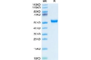 Human CD160 on Tris-Bis PAGE under reduced condition. (CD160 Protein (CD160) (AA 25-158) (Fc Tag))