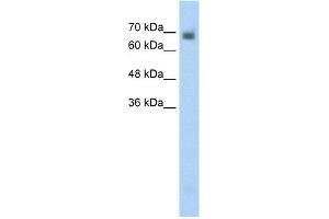 WB Suggested Anti-CRMP1 Antibody Titration:  0. (CRMP1 Antikörper  (N-Term))