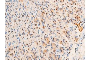 ABIN6267307 at 1/100 staining mouse gastric tissue sections by IHC-P. (C-JUN Antikörper  (pThr93))