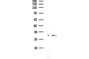 Western blot analysis of lysates from COLO205 cells(heat-shock,45 min treatment), using FSBP Antibody at 1/1000 dilution.
