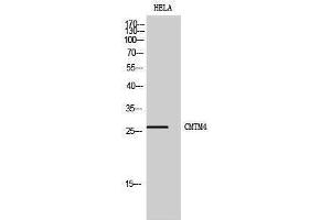Western Blotting (WB) image for anti-CKLF-Like MARVEL Transmembrane Domain Containing 4 (CMTM4) (Internal Region) antibody (ABIN3174457) (CMTM4 Antikörper  (Internal Region))