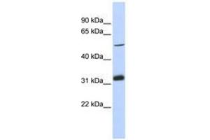 Image no. 1 for anti-Tandem C2 Domains, Nuclear (TC2N) (AA 251-300) antibody (ABIN6741190) (TC2N Antikörper  (AA 251-300))