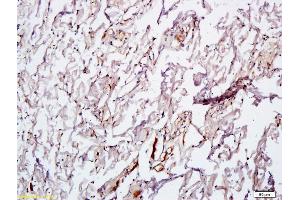 Immunohistochemistry (IHC) image for anti-Vascular Endothelial Growth Factor (VEGF) antibody (ABIN674829)