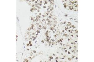 Immunohistochemistry (Paraffin-embedded Sections) (IHC (p)) image for anti-Endothelial Differentiation Related Factor 1 (EDF1) (AA 1-148) antibody (ABIN1679646)