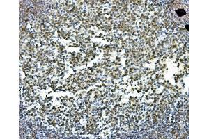 IHC analysis of PRDM5 using anti-PRDM5 antibody (ABIN7600853). (PRDM5 Antikörper  (AA 24-630))