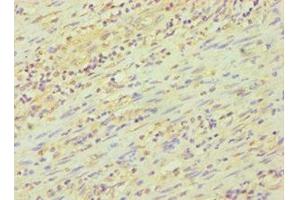 Immunohistochemistry of paraffin-embedded human epityphlon tissue using ABIN7162842 at dilution of 1:100 (FKBP4 Antikörper  (AA 220-459))