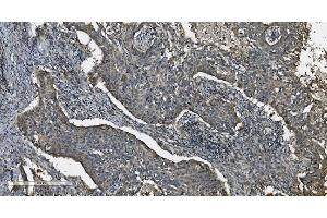 IHC analysis of MAP3K8 using anti-MAP3K8 antibody (ABIN4886663). (MAP3K8 Antikörper  (AA 9-193))