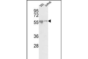 Western blot analysis of CDKL2 Center (ABIN391189 and ABIN2841281) in 293, Jurkat cell line lysates (35 μg/lane). (CDKL2 Antikörper  (AA 226-255))