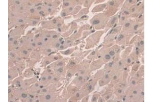 DAB staining on IHC-P; Samples: Human Liver Tissue (HFE2 Antikörper  (AA 234-416))