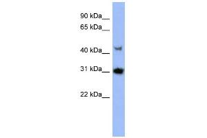 WB Suggested Anti-PRKY Antibody Titration: 0. (PRKY Antikörper  (N-Term))