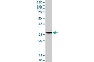 BCAP31 monoclonal antibody (M01), clone 3C5. (BCAP31 Antikörper  (AA 137-246))