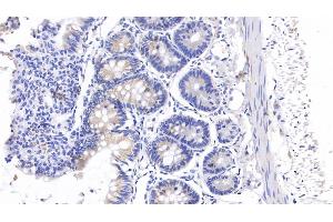 Detection of CEA in Rat Colon Tissue using Polyclonal Antibody to Carcinoembryonic Antigen (CEA) (CEA Antikörper  (AA 209-408))