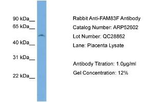 WB Suggested Anti-FAM83F  Antibody Titration: 0. (FAM83F Antikörper  (N-Term))