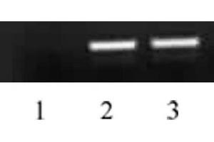 Histone H4 acetyl Lys5 antibody tested by ChIP analysis. (Histone H4 Antikörper  (acLys5))