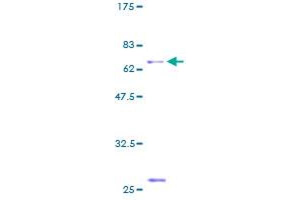 ACRV1 Protein (AA 1-265) (GST tag)