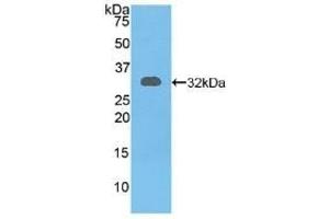 Detection of Recombinant RYK, Mouse using Polyclonal Antibody to Related To Receptor Tyrosine Kinase (RYK) (RYK Antikörper  (AA 287-533))
