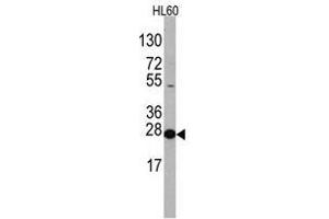 Image no. 1 for anti-Eukaryotic Translation Initiation Factor 4E (EIF4E) (N-Term) antibody (ABIN357297) (EIF4E Antikörper  (N-Term))