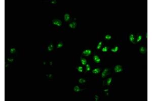 Immunofluorescence staining of Hela cells with ABIN7163056 at 1:233, counter-stained with DAPI. (PHF6 Antikörper  (AA 2-312))