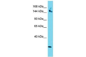 Host: Rabbit Target Name: CCDC141 Sample Type: HepG2 Whole Cell lysates Antibody Dilution: 1.