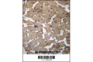 MGAT4C Antibody immunohistochemistry analysis in formalin fixed and paraffin embedded human skeletal muscle followed by peroxidase conjugation of the secondary antibody and DAB staining. (MGAT4C Antikörper  (C-Term))